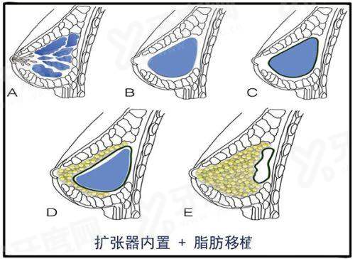 三、真实用户口碑反馈与术后成效如何?yanke.yadoo.cn