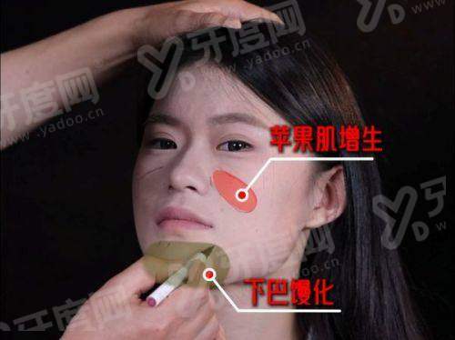 二、韩国釜山本思皮肤科有哪些特色优势与技术亮点?yanke.yadoo.cn