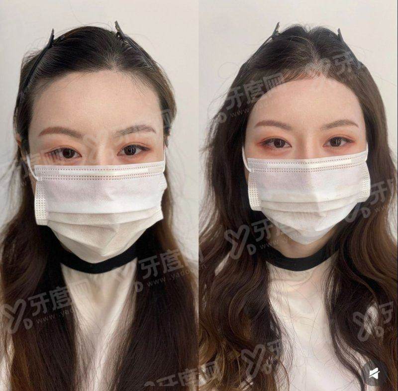 一、韩国济州 PPEUM 皮肤科预约入口汇总的核心解答与便捷通道yanke.yadoo.cn