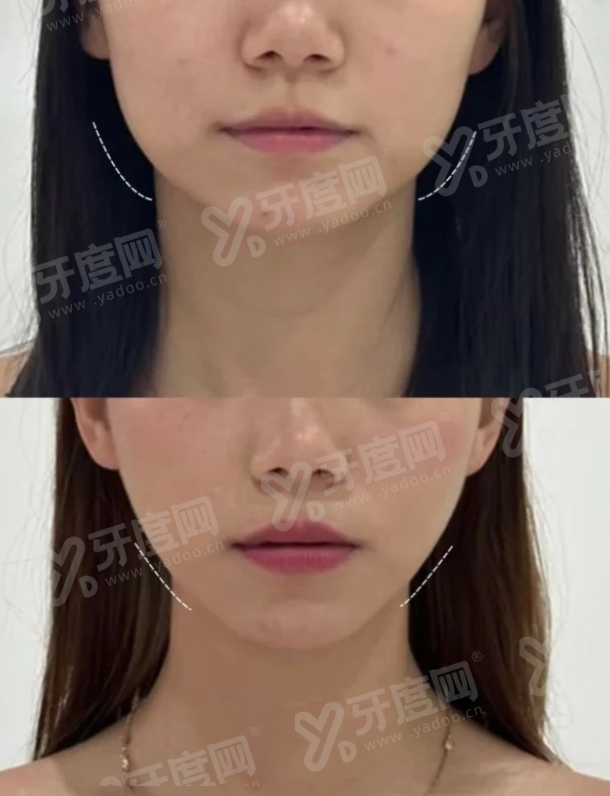 二、釜山德佛斯特皮肤科有哪些特色项目与价格参考?yanke.yadoo.cn