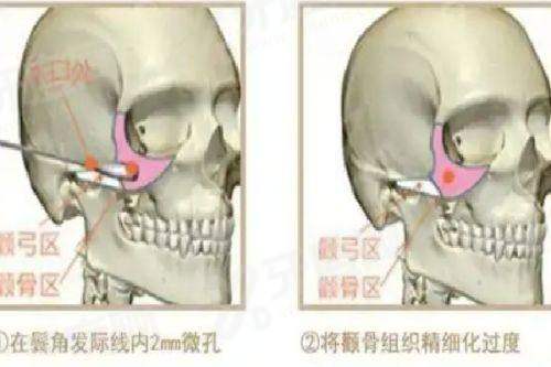 三、韩国陶瓷医院的真实口碑评价与透明价格体系是怎样的?yanke.yadoo.cn