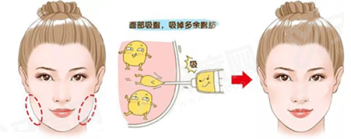 二、韩国陶瓷医院有哪些特色技术与经验较丰富的医生团队?yanke.yadoo.cn