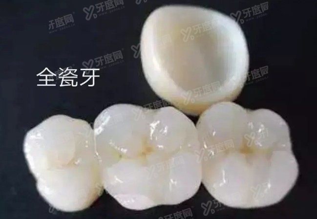 全瓷牙多少钱一颗价格表2022www.yadoo.cn
