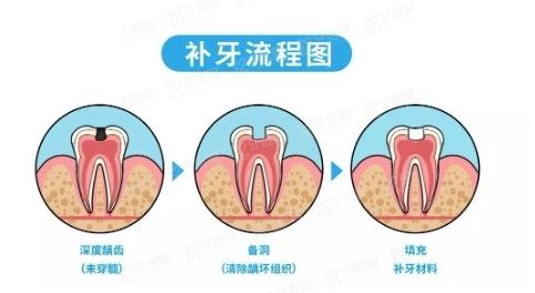 牙缝宽怎么补？www.yadoo.cn