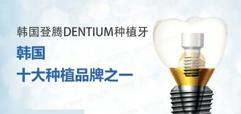 登腾和奥齿泰哪个使用寿命长www.yadoo.cn