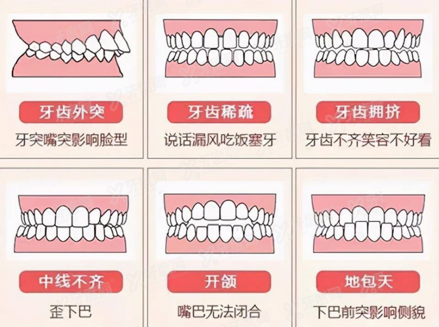 牙中线不齐的后果.jpg