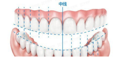 牙中线不齐导致脸歪可以矫正.jpg