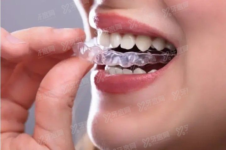 ，慈溪牙齿矫正价格表<span style=
