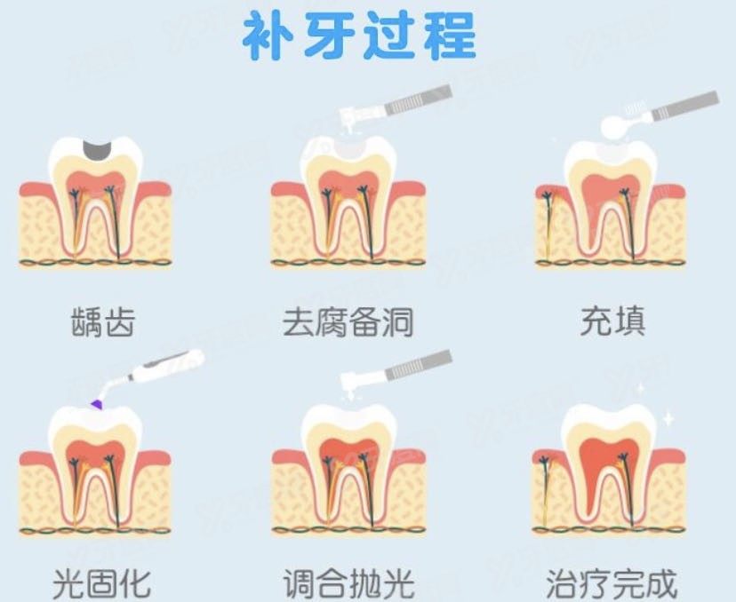 长沙优伢仕口腔团购多少钱.jpg