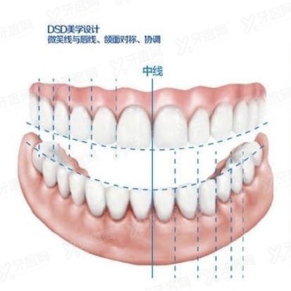 前牙美学修复是什么及修复方式.jpg