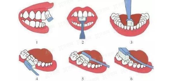 因刷牙方式不当引起的牙龈萎缩怎么办?来试试改良巴氏刷牙法.jpg