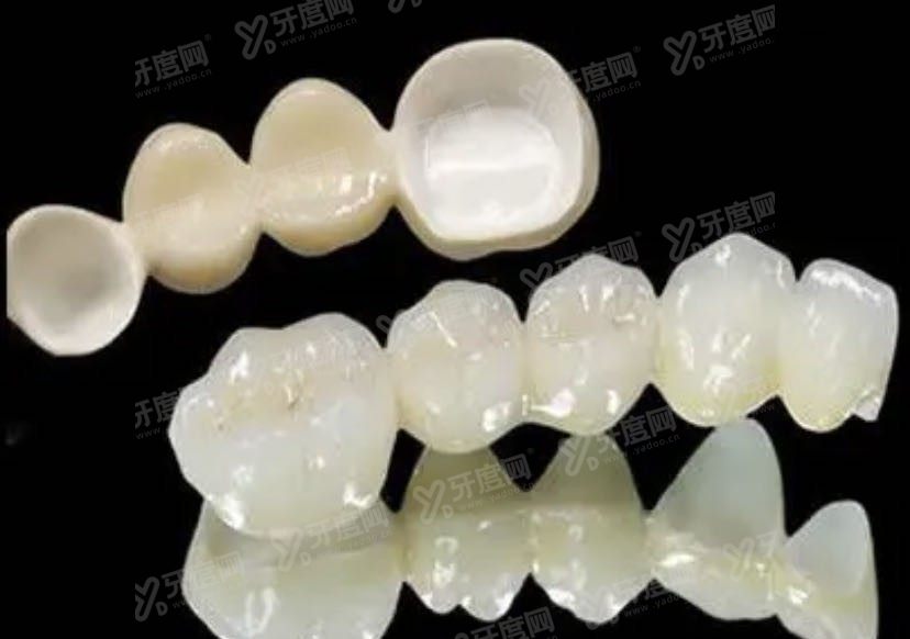 牙齿缺失的修复方式.jpg