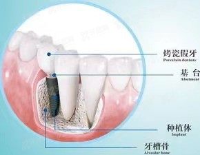 宜都牙科收费价格表.jpg