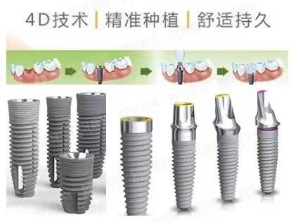 瑞典诺贝尔种植体有几种型号www.yadoo.cn