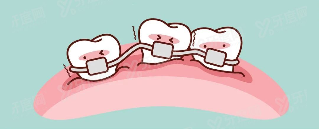 牙齿矫正.jpg 牙齿矫正.jpg