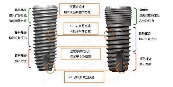 种植牙的流程和注意事项有哪些？种植牙的流程5——备制螺纹.jpg