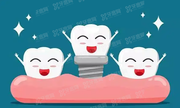 种植牙.png