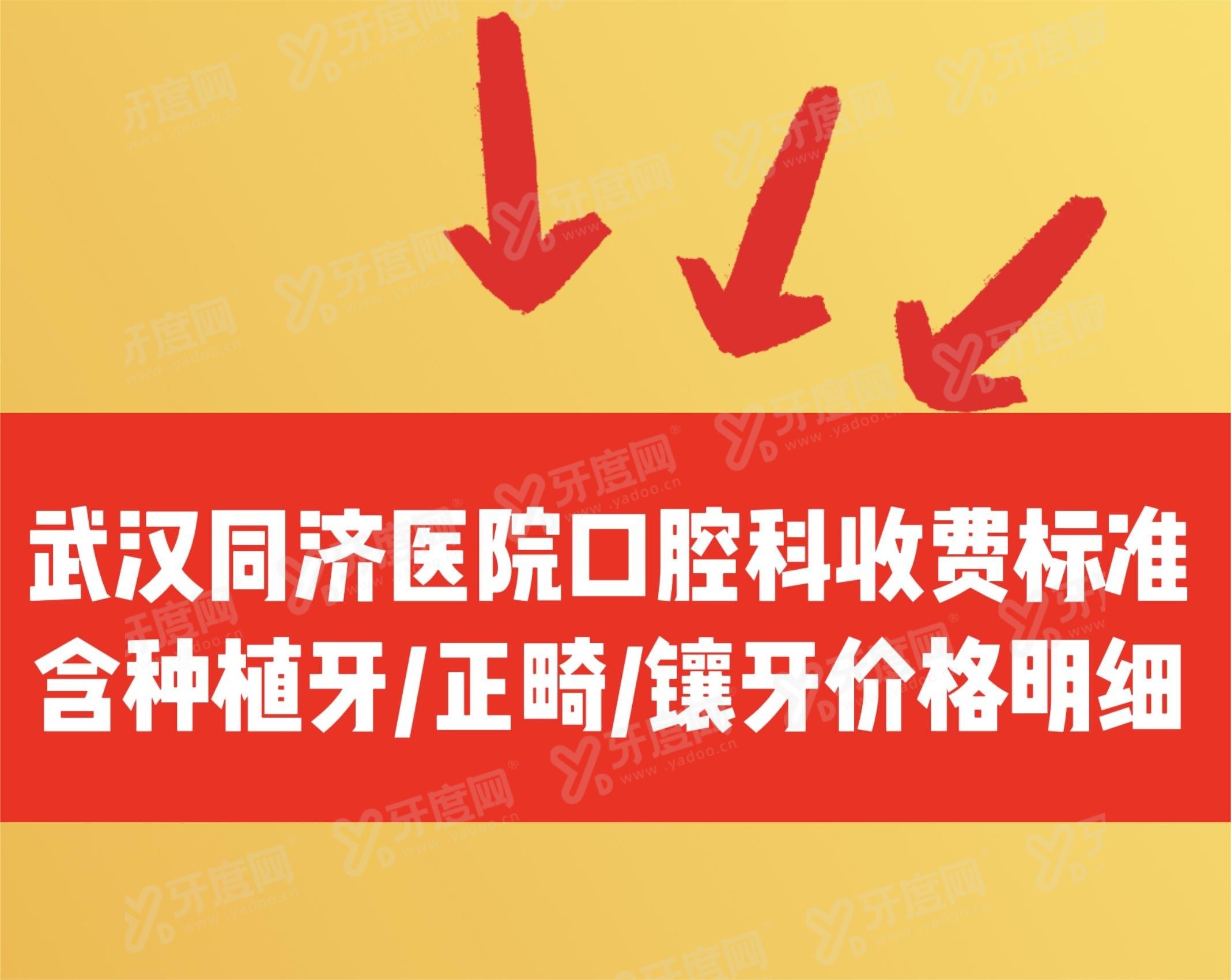 武汉同济医院口腔科收费标准www.yadoo.cn