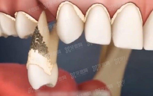 牙齿松动是什么原因www.yadoo.com