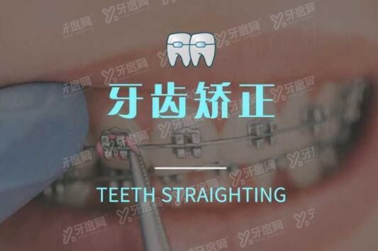 上海悦康口腔牙齿矫正价格表