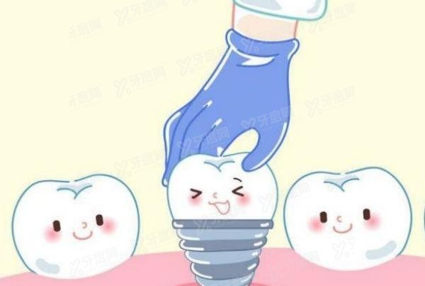 抚州种植牙医院排名榜前十名m.yadoo.cn
