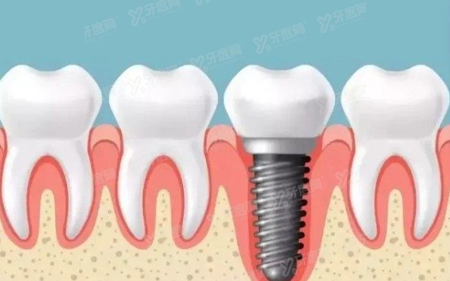 德韩口腔医院收费价格表www.yadoo.cn