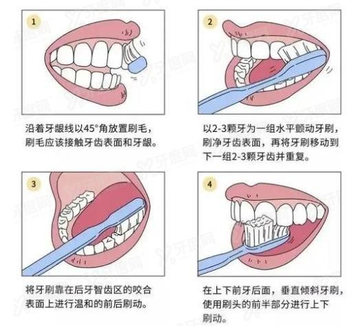 种植牙要怎样护理才好？www.yadoo.cn