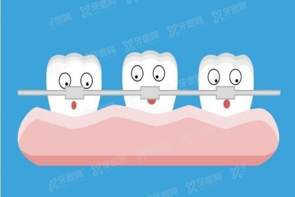 汕头口腔医院矫正牙齿收费标准www.yadoo.cn