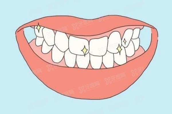 汕头口腔医院矫正牙齿收费标准www.yadoo.cn