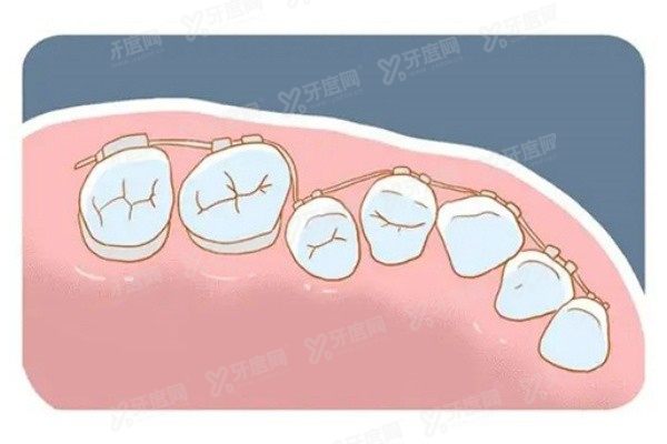 广州德伦口腔优惠活动力度大吗？力度大！yadoo.cn