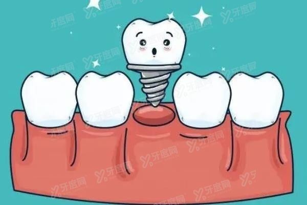 佛山种植牙医生排名前十www.yadoo.cn