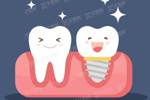 烟台口腔医院种植牙价格表www.yadoo.cn