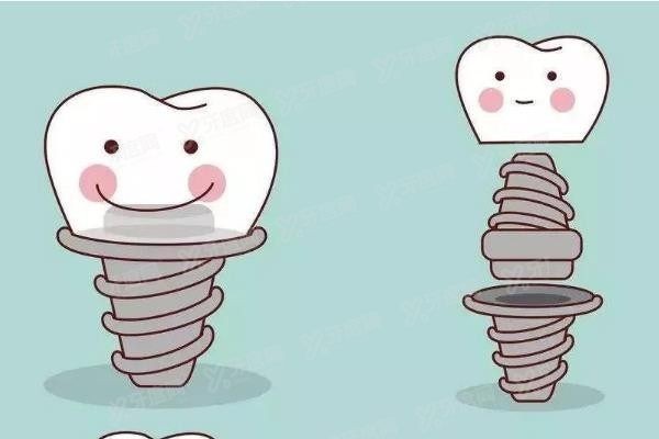 广州穗华口腔医院怎么样www.yadoo.cn 广州穗华口腔医院怎么样www.yadoo.cn