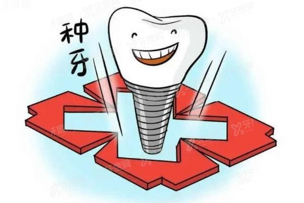 重庆荣昌种植牙价格表www.yadoo.cn