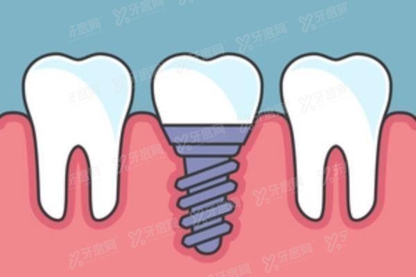 天津南开区种植牙医院排名前十www.yadoo.cn