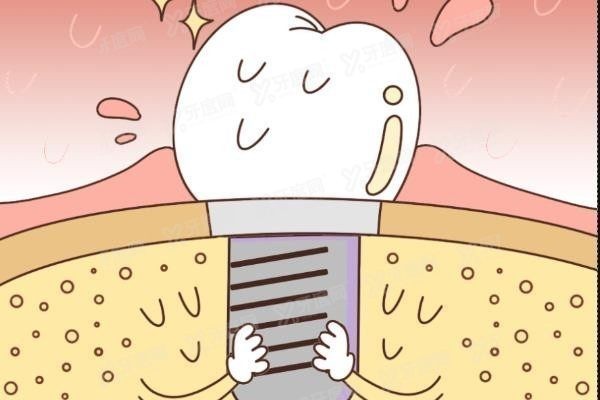 兰州种植牙医生排名前十www.yadoo.cn 兰州种植牙医生排名前十www.yadoo.cn