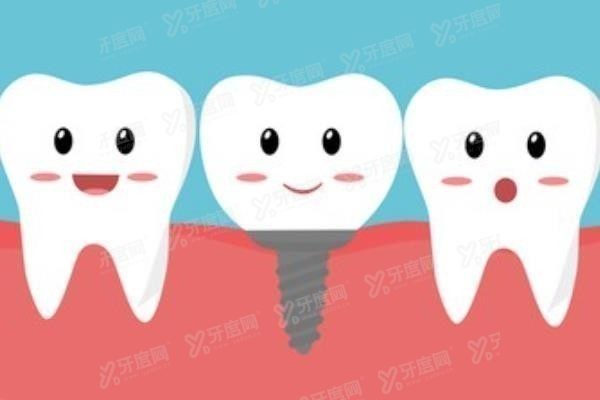 兰州种植牙医生排名前十www.yadoo.cn