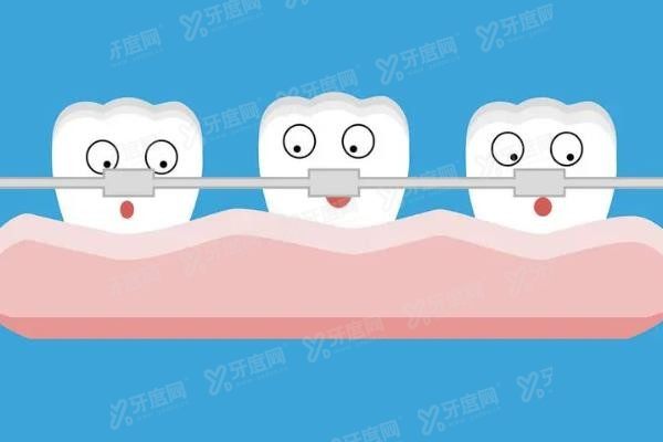 咸阳口腔医院牙齿矫正价格表www.yadoo.cn