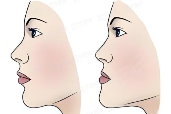 昆明医科大学附属口腔医院正颌手术费用www.yadoo.cn