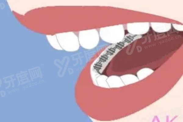 上海博衡口腔医院仇玲医生怎么样www.yadoo.cn