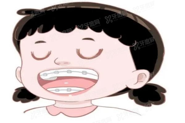 矫正牙齿要多少钱www.yadoo.cn