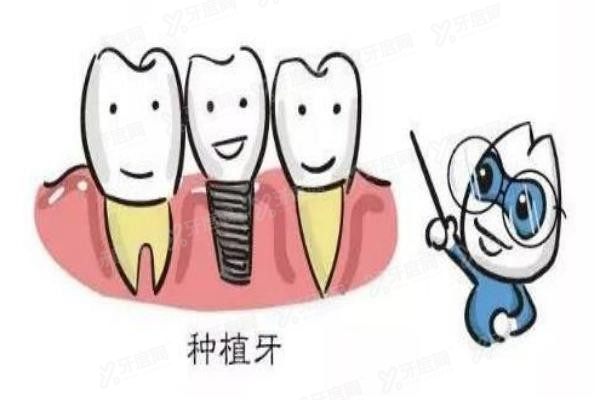 承德种植牙哪家医院好www.yadoo.cn