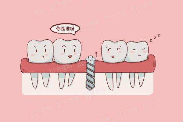 日照口腔医院种植牙收费标准www.yadoo.cn