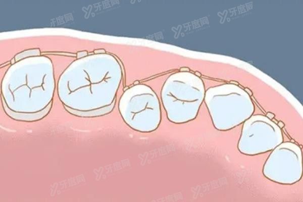 北京昌平区口腔医院牙齿矫正价格表www.yadoo.cn