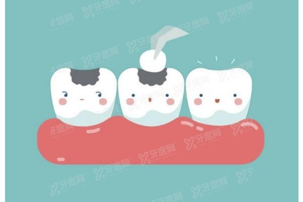 玉林口腔医院价目表2024www.yadoo.cn