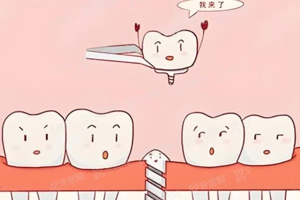 杭州滨江区种植牙价格表www.yadoo.cn