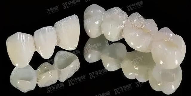 烤瓷牙多少钱一颗2024价格表