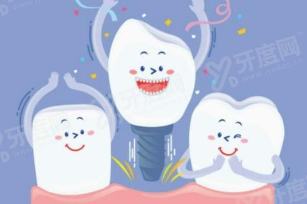 50-60岁种植牙价格表www.yadoo.cn