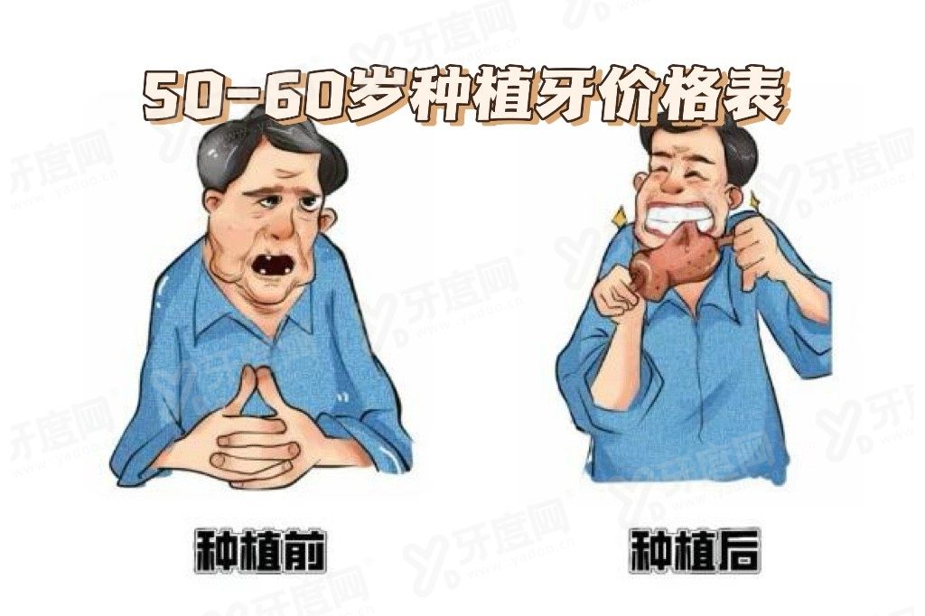 50-60岁种植牙价格表www.yadoo.cn