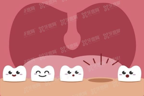 岳阳口腔医院种植牙收费价格表www.yadoo.cn